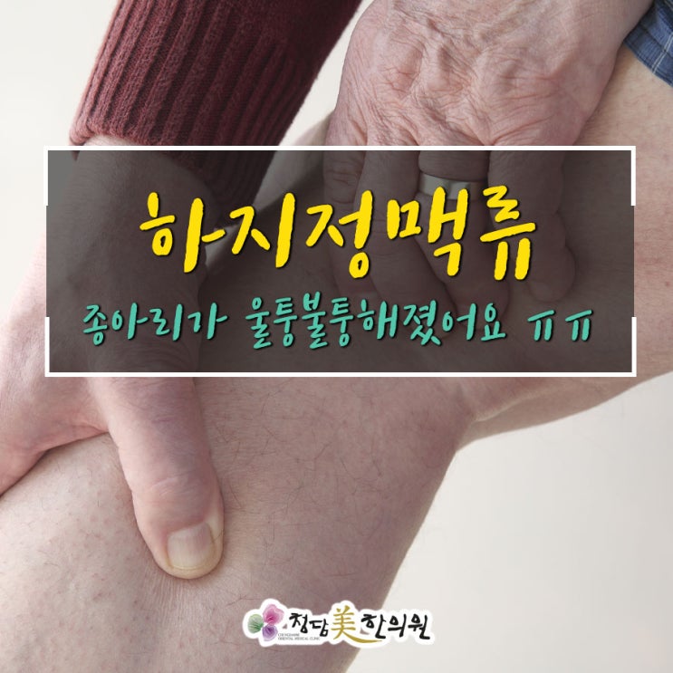 대구 하지정맥류 수술없이 체질적 근본원인치료 다리부종통증 청담미한의원 대구 하지정맥류 수술없이 체질적 근본원인치료 다리부종통증 청담미한의원