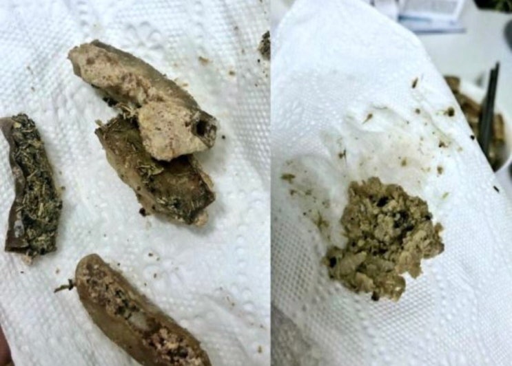  곱창안에 소배설물 이물질이 가득~보상의 규모가 커서 보상을 진행못함