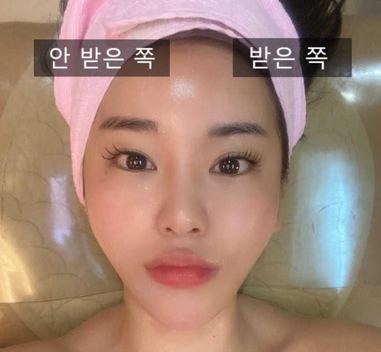  강남 경락 뷰티 테라피에서 경락 받은 후기(전후차이)