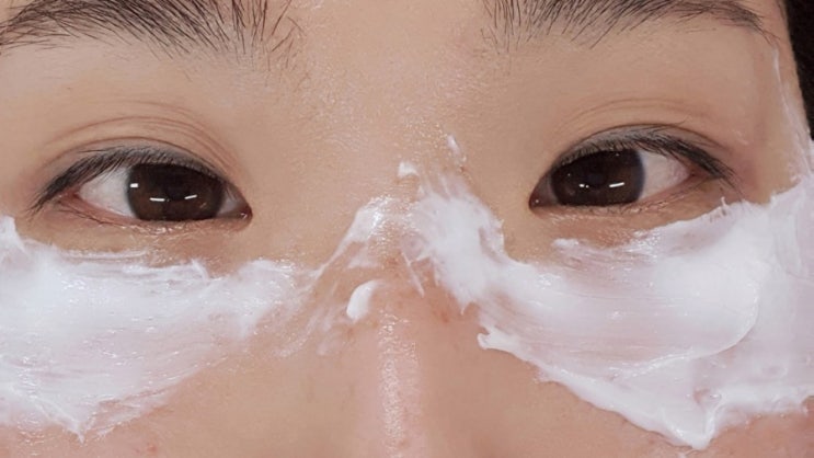 한관종 비립종 좁쌀종 제거 레이저 시술 후기 한관종 비립종 좁쌀종 제거 레이저 시술 후기