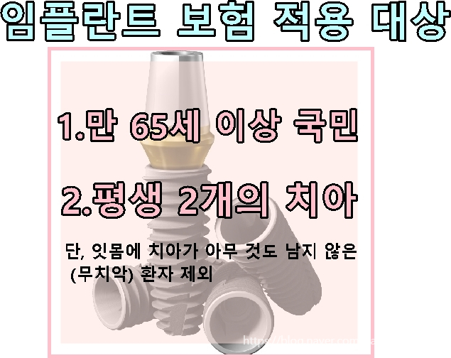 당감동치과건강보험임플란트본인부담금