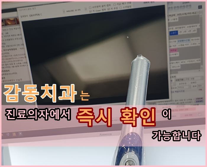  당감동치아충치,균열의정확한진단감동치과