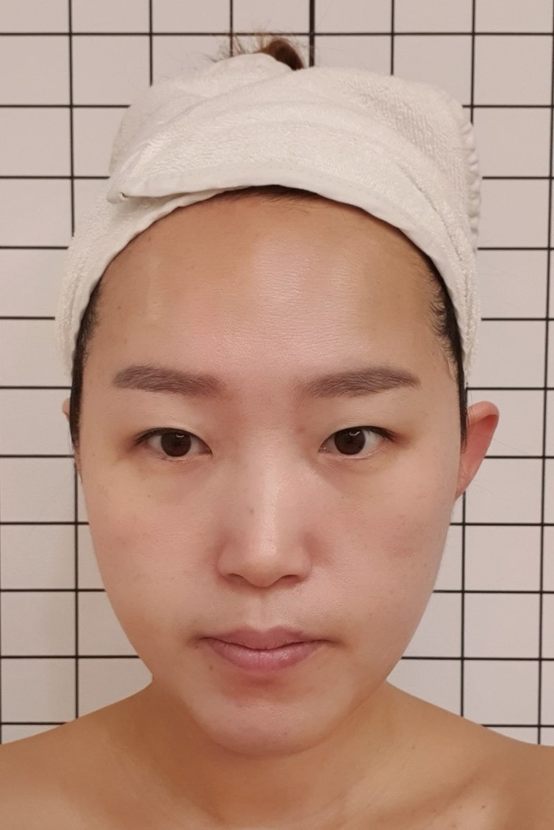 일산경락의 얼굴관리를 받으며 달라진 모습 비교