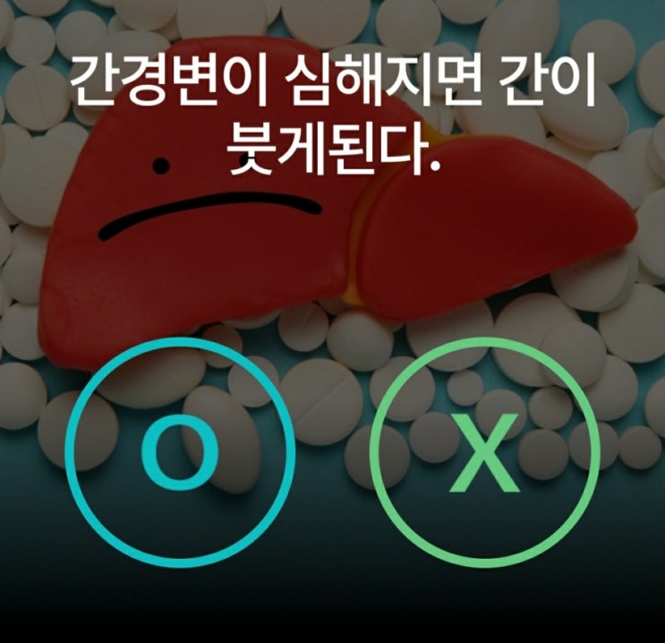  케어나우퀴즈 4월13일 간경변증
