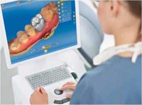 홍대치과/신촌치과/마포치과/연세마이바른이치과-왜 CEREC(세렉)인가? 원데이 인레이 충치 치료 : 네이버 블로그