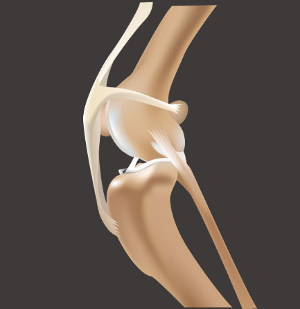  반려견 보조기, 휠체어 전문 네발로에서 강아지 급성,만성 전방 십자 인대 파열에 대한 원인,증상,재활치료!!