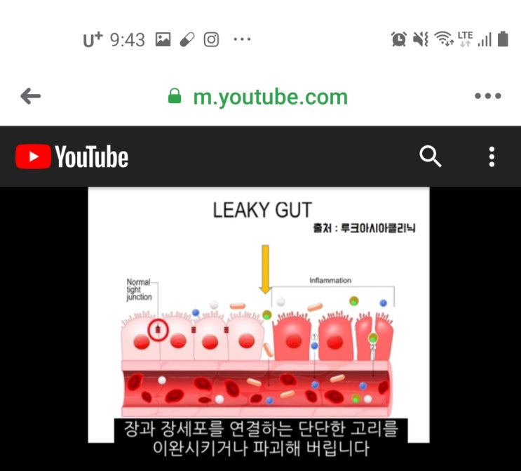  #장누수#파마넥스#화이버넷#프로바이오틱스#본포뮬러