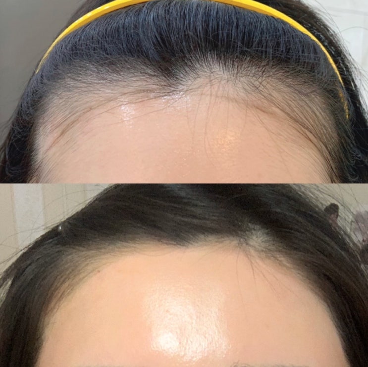  청라왁싱잘하는곳 [캐치업왁싱] 풀페이스왁싱 도전기