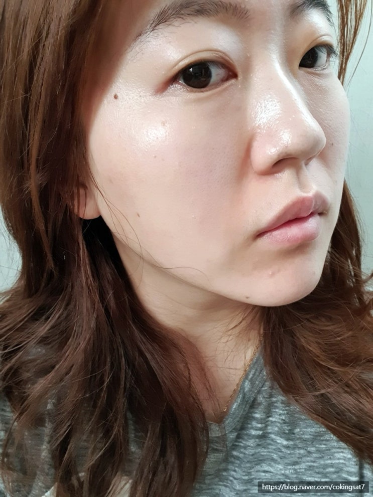  홍대 슈링크 300샷 리프테라 물방울리프팅까지 !!!! 피부관리받고 예뻐지고 오기