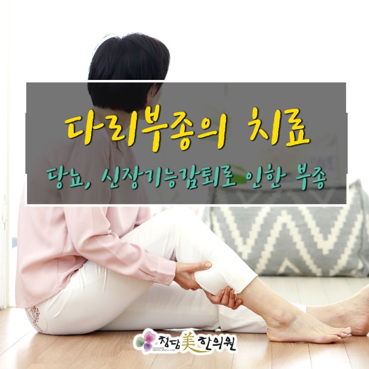 오랜 당뇨, 신장기능 감퇴로 인한 다리 하지부종 한방치료로 가능합니다. 오랜 당뇨, 신장기능 감퇴로 인한 다리 하지부종 한방치료로 가능합니다.