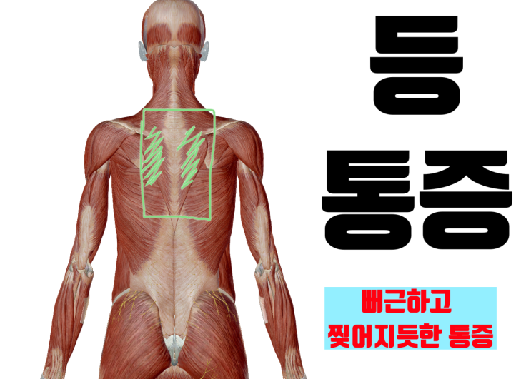 오래 앉아있으면 날개뼈 안쪽, 등 통증이 생긴다면[영통 새움한의원]