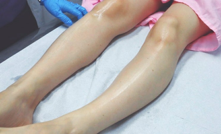  [오목교 왁싱]'레아뷰티'  다리왁싱 후기! 면도기제모보다 편해~왁싱관리법