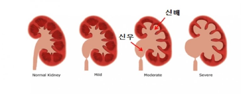 수신증의 증상은 무엇입니까? 7