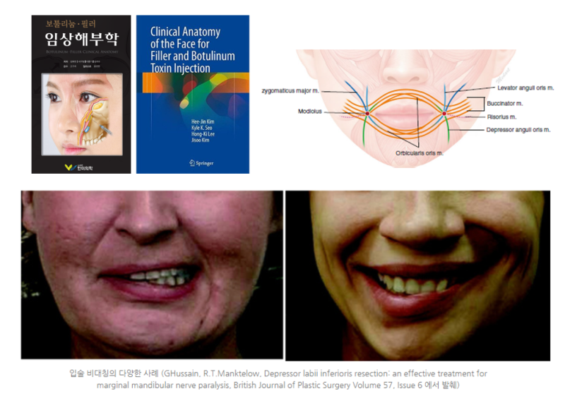 대전구각보톡스 긍정적인 이미지를