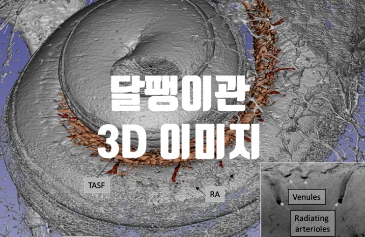  첨단 3D 이미지를 이용한 내이 혈관 지도 작성