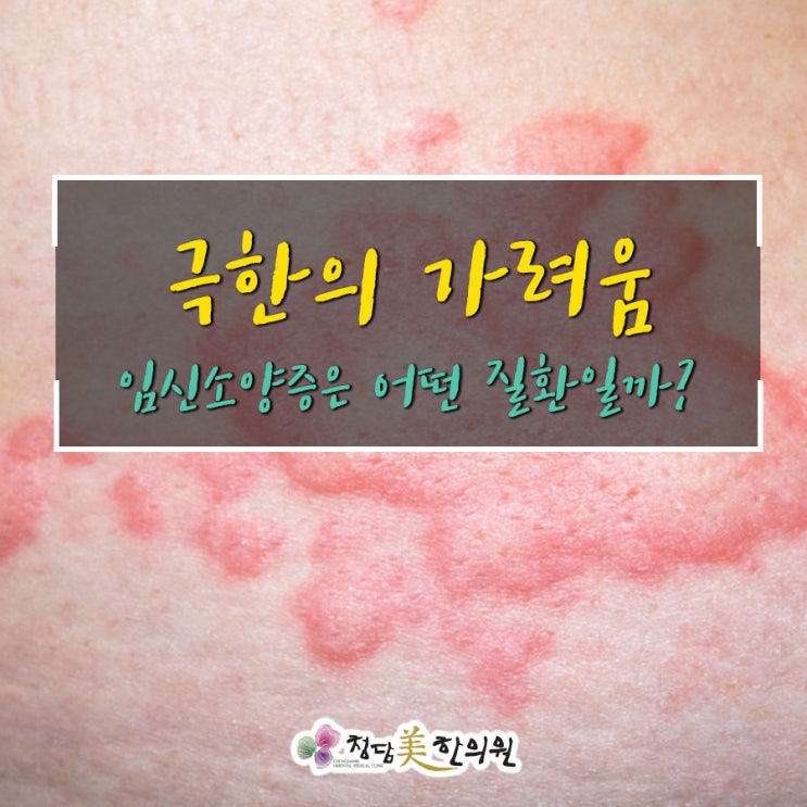 대구 임신소양증 임신피부가려움증 약물부작용없는치료 청담미한의원 대구 임신소양증 임신피부가려움증 약물부작용없는치료 청담미한의원