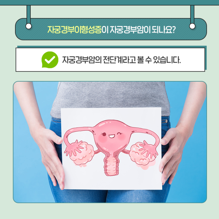 자궁경부이형성증의 원인과 증상, 자궁암의 전 단계라고? 8