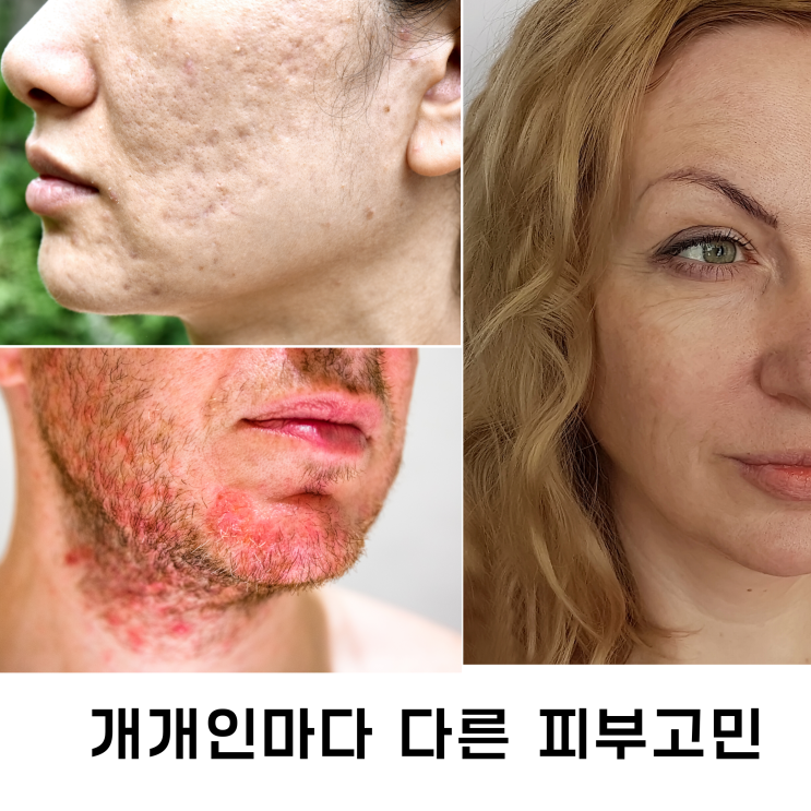  정말 쉬운피부관리 집에서하기(세멘시트6차)