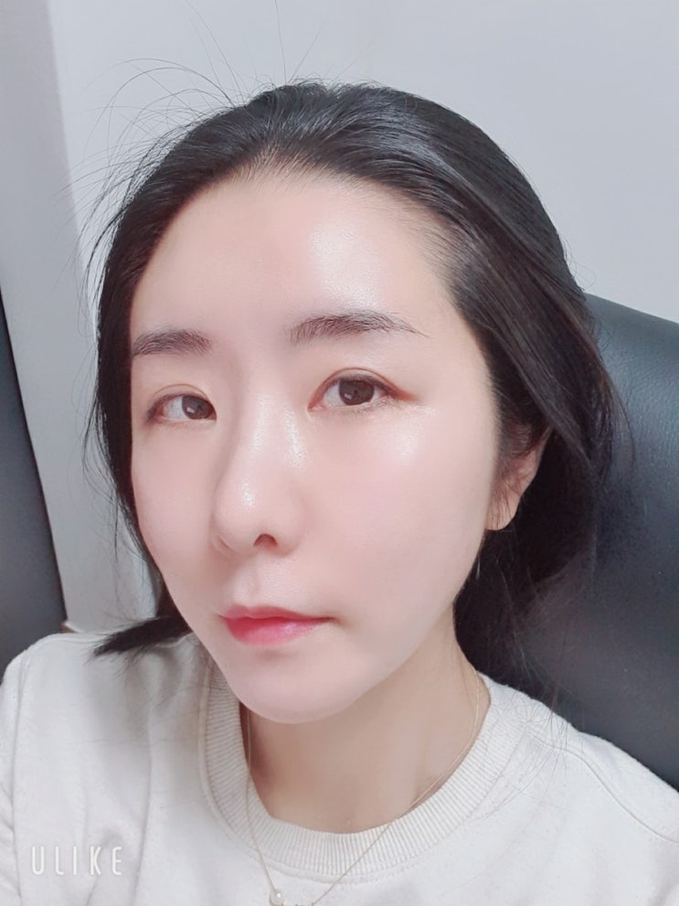  마지막으로 올리는 5G리프팅 3개월 후기