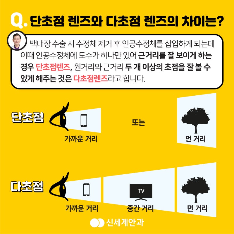 노안다초점렌즈 및 백내장의 차이 9