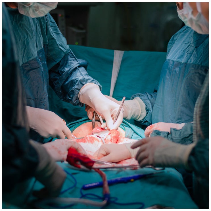  자궁근종 자궁적출, 꼭 할 필요 없습니다
