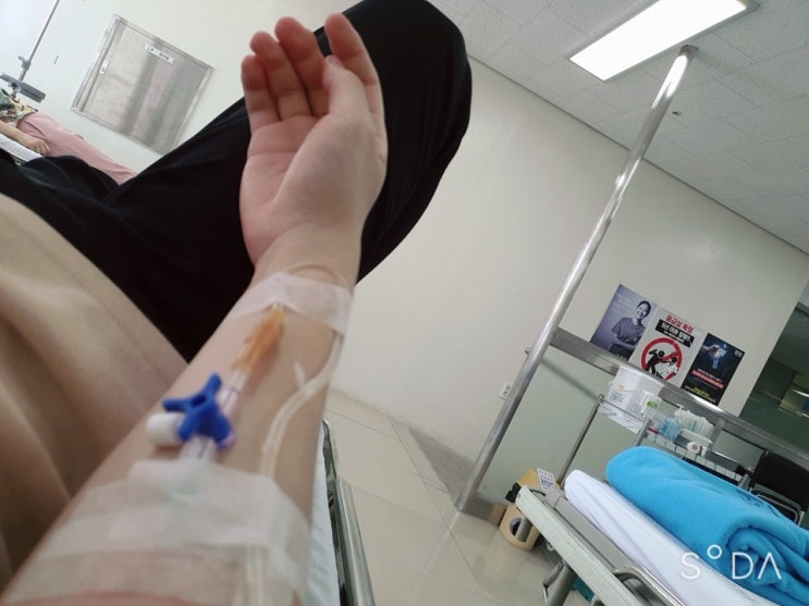  맹장수술 후기!(증상, 병원비 등)