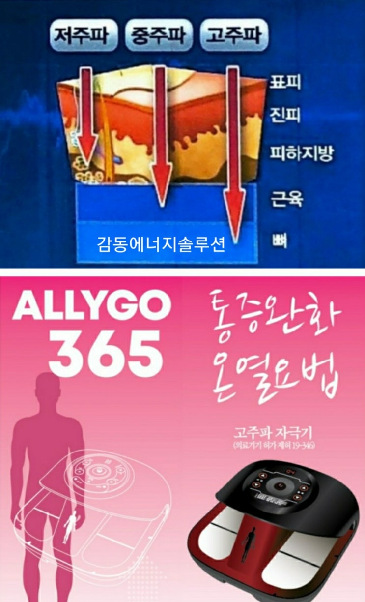 →온체 고주파자극기 손발 저림에 좋습니다! 상담 가능! 7