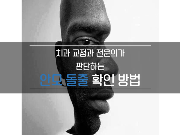 돌출안모/입돌출 확인하는 방법 - 교정과 전문의가 판단하는 안모돌출 확인법 돌출안모/입돌출 확인하는 방법 - 교정과 전문의가 판단하는 안모돌출 확인법