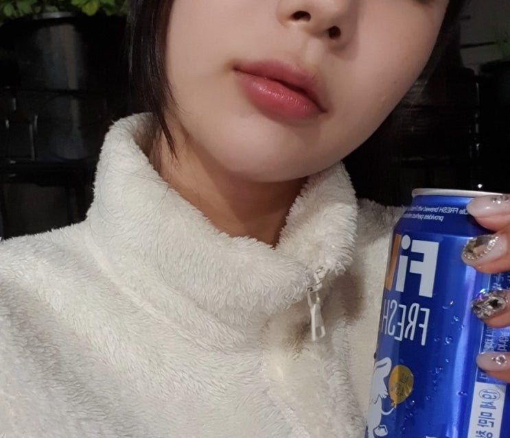  입술필러후기 찾다 열받아서 직접 동생이랑 맞고옴(+입꼬리 보톡스)