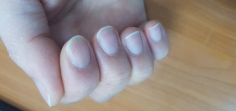 손톱 반달 건강 알아보기 1