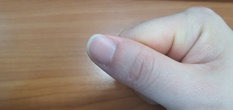 손톱 반달 건강 알아보기 2