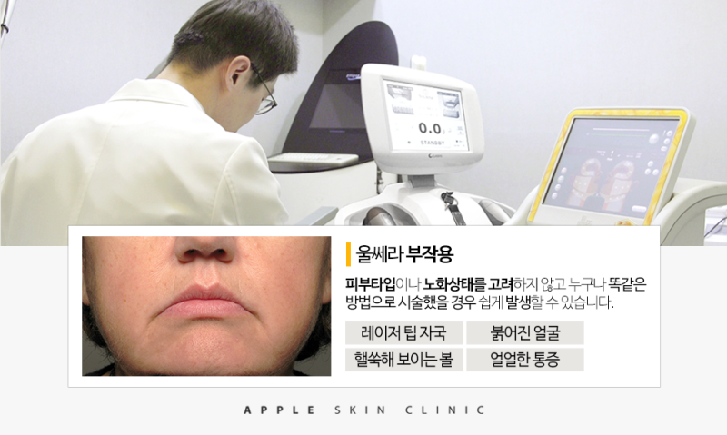 대구 리프팅 잘하는 데 제대로 시작하려면? 4