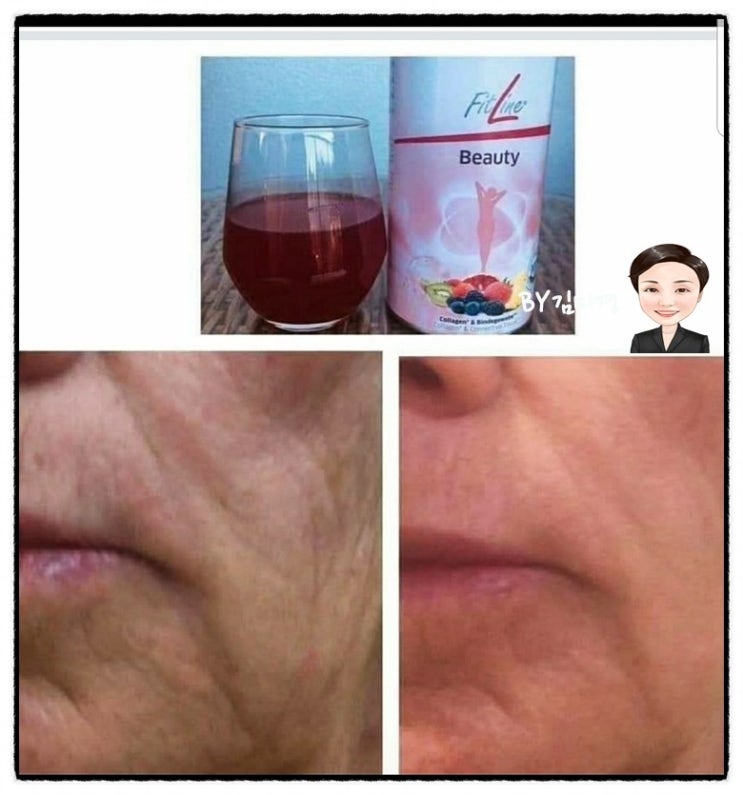  보이는 피부와 보이지 않는 피부, 콜라겐과 뷰티 플러스 나를 건강하고 아름답고 젊어지게 하네요
