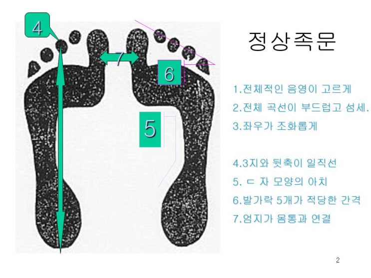  오소틱 기능성깔창 교정구로서 가치가 있을까?