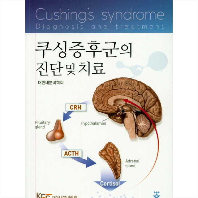 [품절예상][가성비굿]쿠싱증후군 Top 20