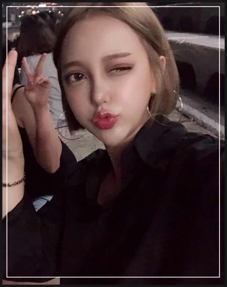  졸린눈교정 고민이라면? 안검하수 일 수 있습니다.