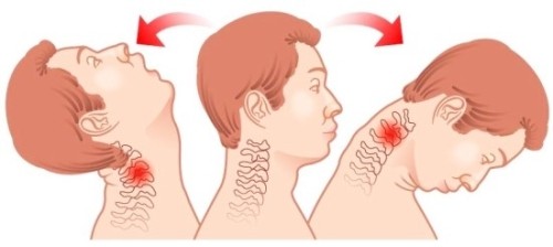 수성구만촌네거리범어네거리 교통사고치료한의원 자동차보험물리치료 청담미한의원 수성구만촌네거리범어네거리 교통사고치료한의원 자동차보험물리치료 청담미한의원