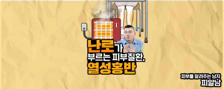  [열성홍반] 전기장판 피부병