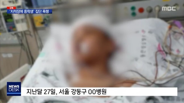 지적장애 중학생 집단 폭행, 운동부 가해자학생.."축구공처럼 찼다"