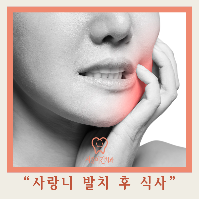 사랑니 발치 후 식사 시 주의사항과 붓기 관리 방법 네이버 블로그