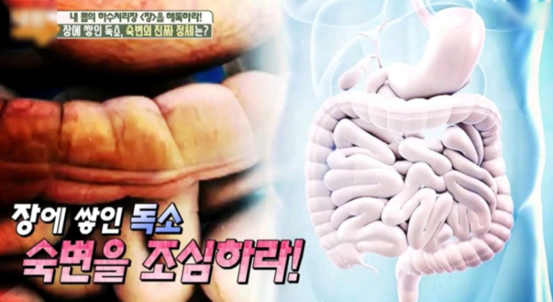 숙변제거 방법, 음식으로 이뤄내세요