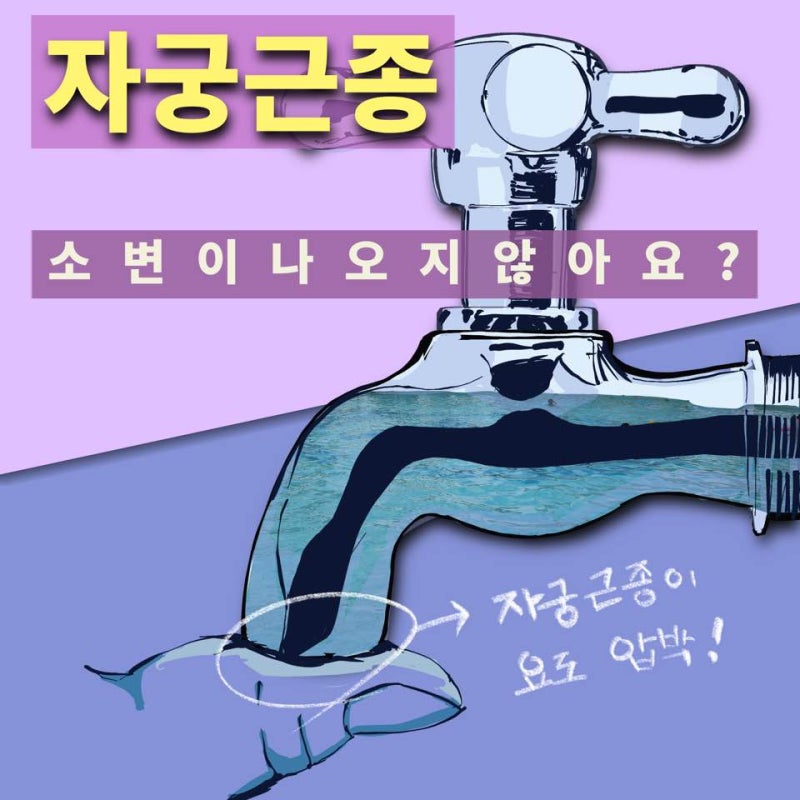 자궁근종 때문에 소변을 못 본다?