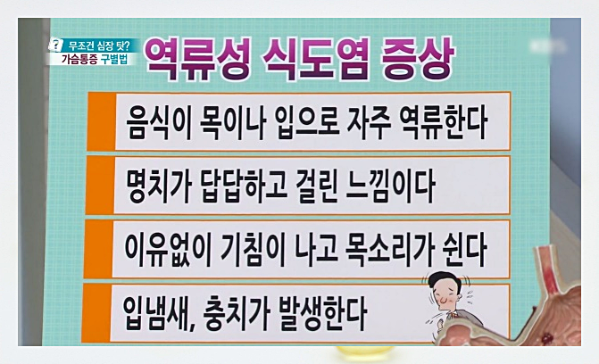 역류성 식도염 증상과 유발 원인 치료법 7