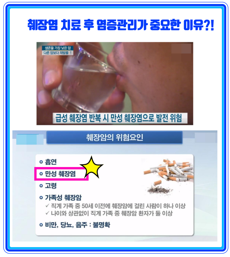 췌장염 치료 시 기준이 되는 3