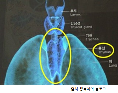 면역세포 만드는 ‘흉선’, 퇴화하지 않으면 ‘흉선암’과 ‘중증근무력증’의 원인 : 네이버 블로그