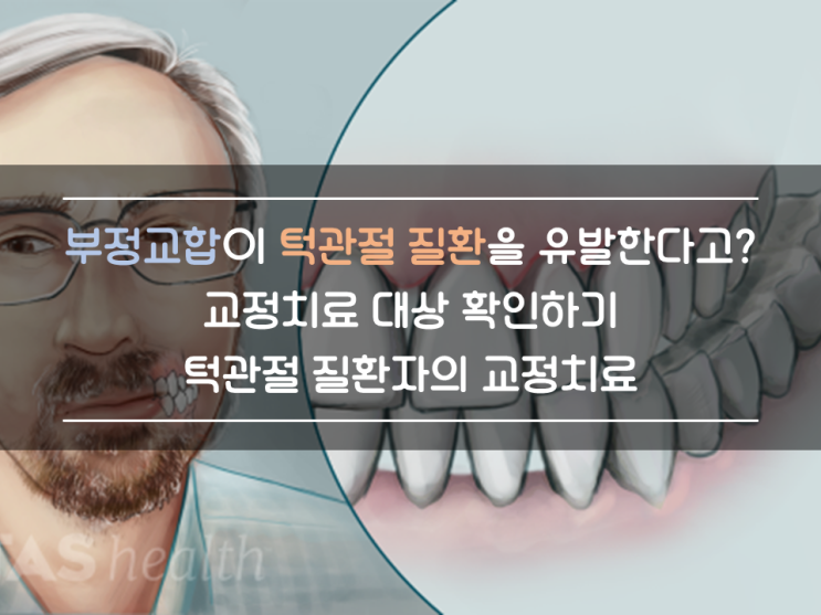 부정교합(malocclusion)이 턱관절 문제(TMJ problem/TMD)를 일으킨다고? 교정치료 필요한 경우는?