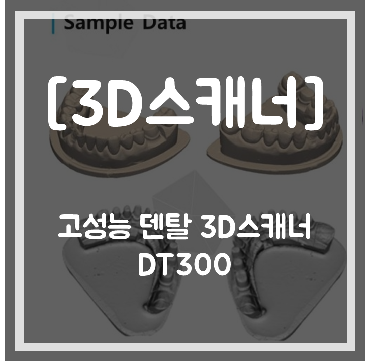 [3D스캐너]합리적인 가격의 고성능 덴탈 3D스캐너 DT300