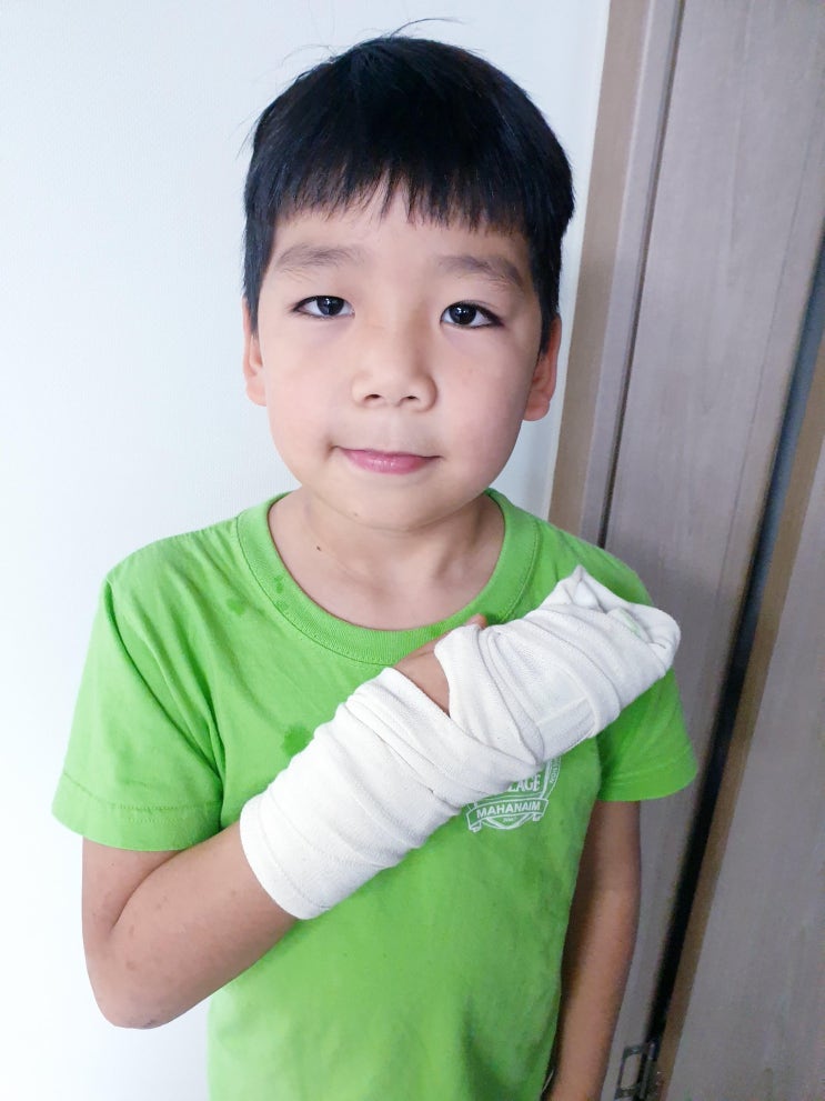  에스보드 타다 결국 사고쳤네