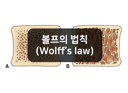 볼프의 법칙(wolff's law) 알아보기!!