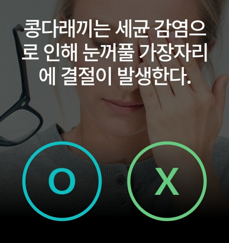  콩다래끼의 원인과 증상